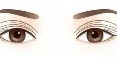 雙眼皮4 (2).png