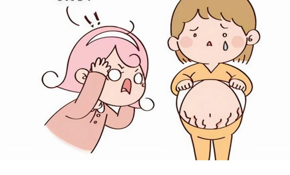 激光改良妊娠紋1.png