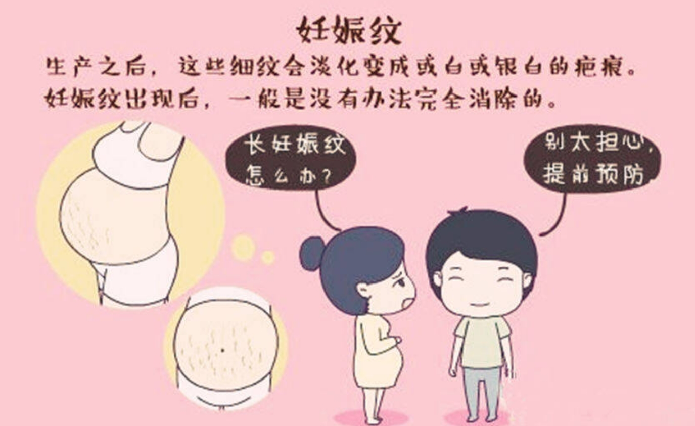 激光改良妊娠紋3.png