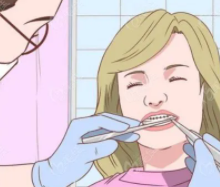 牙齒矯正18.png 牙齒矯正18.png